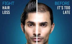 ustraa hair growth cream (100 g)